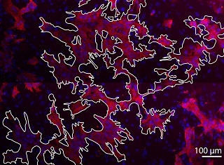 Рисунок 1. На фотографии, сделанной с помощью конфокального микроскопа, белым контуром выделен проводящий путь из кардиомиоцитов в монослое сердечной ткани (31% кардиомиоцитов и 69% непроводящих клеток). Кардиомиоциты помечены розовым цветом, ядра – синим. Фото стало обложкой  журнала PLOS Computational Biology